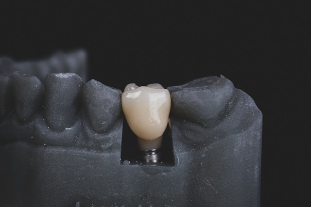 Black model of teeth with white implant